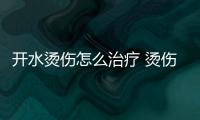 开水烫伤怎么治疗 烫伤应急处理方法